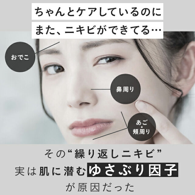 FANCL FDR 粉刺護理化妝水 FDR Acne Care Lotion 30mL